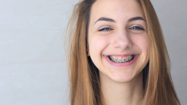 Beautiful smiling girl with retainer for teeth  .