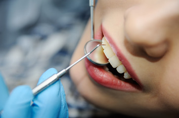 teeth of a beautiful girl closeup. girl at the dentist