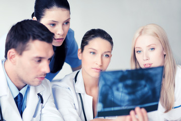 Fototapeta premium group of doctors looking at x-ray