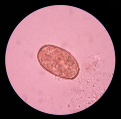 parasite egg in stool exam.