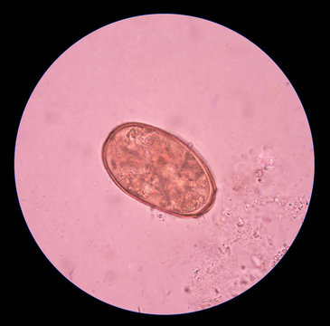 parasite egg in stool exam.