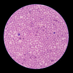 red blood cells
