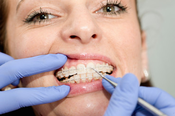 Orthodontist tightening braces