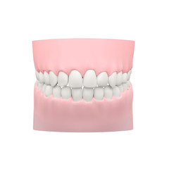 White Teeth Model, Dental Model