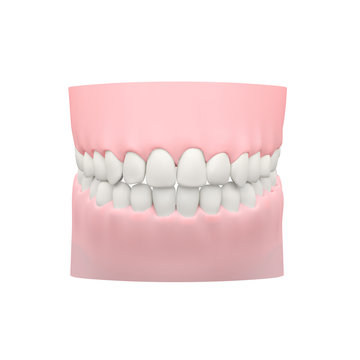 White Teeth Model, Dental Model