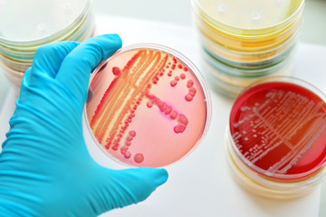 Colonies of bacteria in culture medium plate
