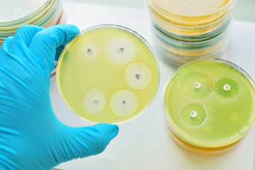 Antimicrobial susceptibility testing in petri dish

