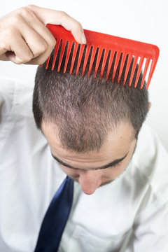 hair loss issue