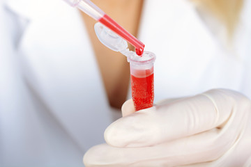 Wissenschaftler mit Blutprobe in Labor für Untersuchung und Auswertung