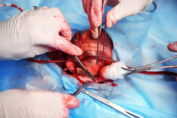 Doctor doing heart operation