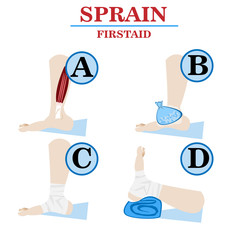 Sprain firstaid vector infographic image