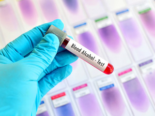 Fototapeta premium Blood sample for alcohol test