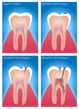 tooth and gum anatomy and damage