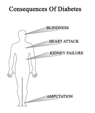 Consequences Of Diabetes