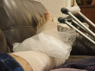 Obraz na płótnie Canvas Broken Foot Icing and Elevated on Couch With Crutches in Background