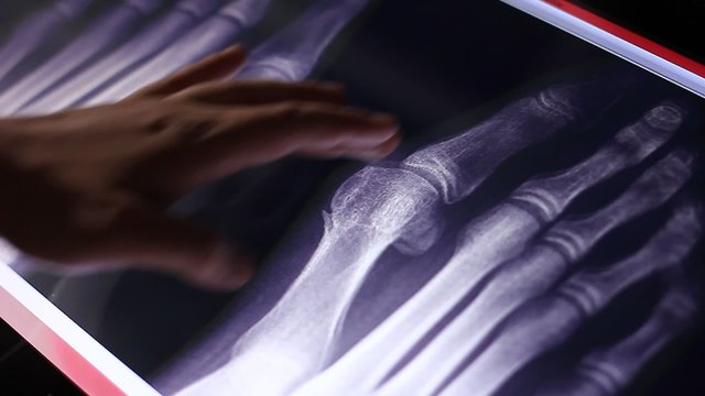 Doctor examines human feet bones fluorography scan on touch screen computer