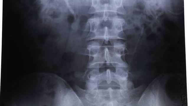 X-rays are a type of electromagnetic radiation, just like visible light.