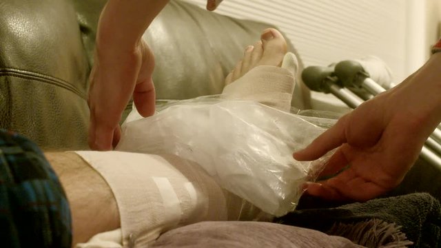 Ice Pack on Sprained, Broken, Fractured Ankle