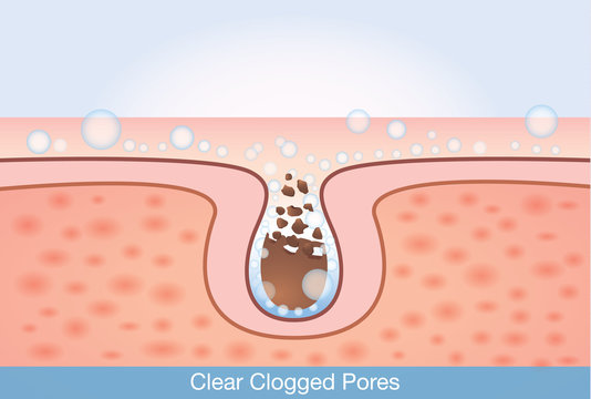 Deep cleaning unclog pores. This illustration about skin care and beauty.