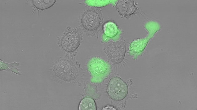 PC-3 human prostate cancer cell lines are one of the cell lines used in prostate cancer research.
