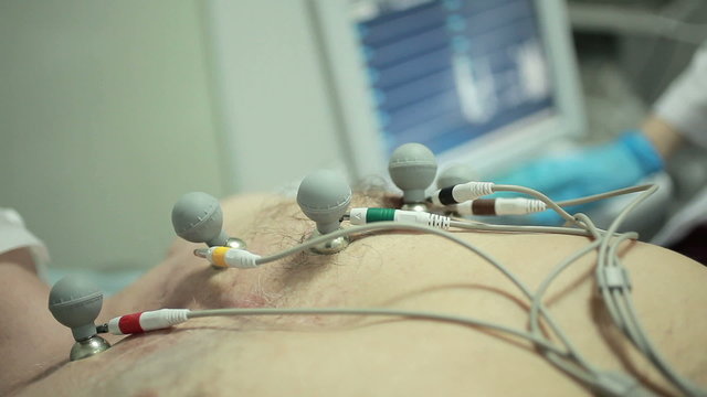 Ecg test of man at hospital. Close up.