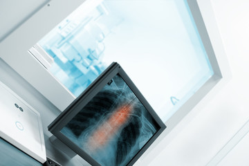 Computer in the x-ray cabinet