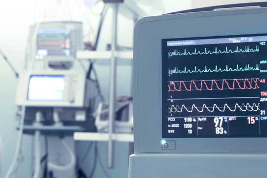 Monitor equipment with vital parameters in ICU