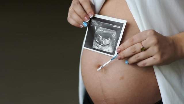 A pregnant young woman holds a picture and a pregnancy test in the abdominal area. Slow motion