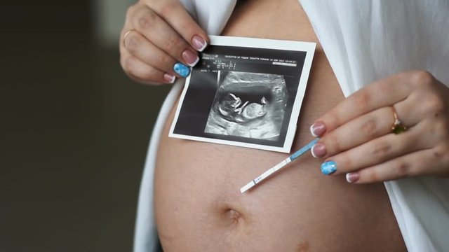 Young pregnant woman holding ultrasound of the abdomen. In his left hand a pregnancy test. Slow motion