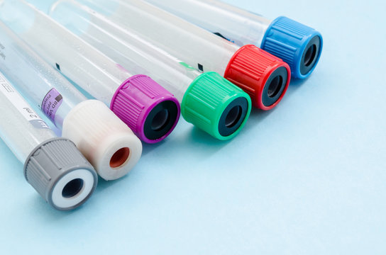 Medical Blood tube, test tube for laboratory.