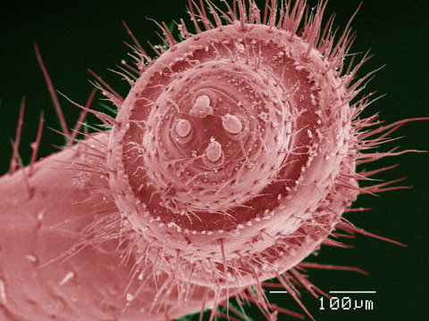 Coloured SEM of millipede antenna