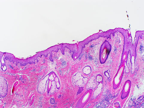 H&E stain, light microscopy, normal skin of scalp