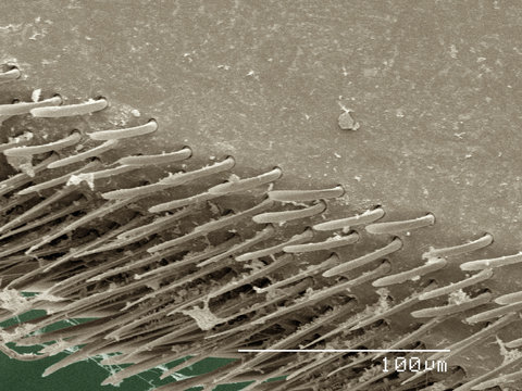 Coloured SEM of backswimmer (Notonectidae) leg
