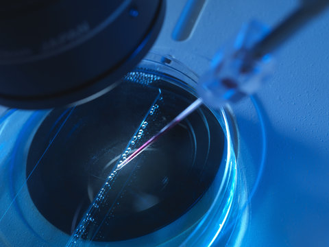 Nuclear transfer, Stem cells made from the cell nucleus