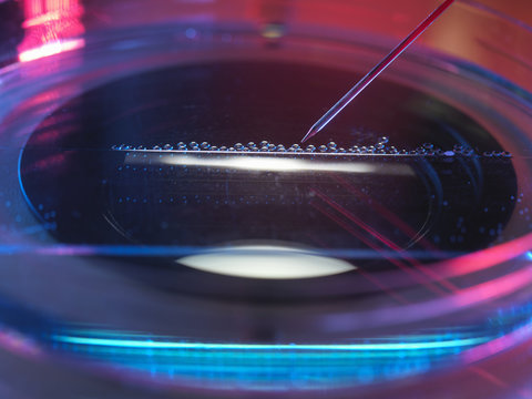 Nuclear transfer, Stem cells made from the cell nucleus