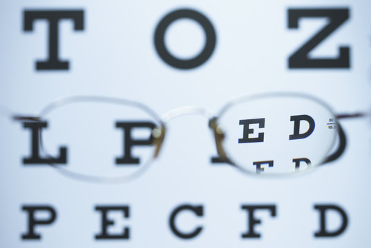 Spectacles with one myopic lens (negative) and the other is missing are used to look at the Snellen eye chart. The image is in focus when looking through the lens