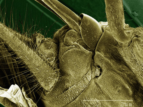 Coloured SEM of house cricket (Acheta domesticus) leg spurs