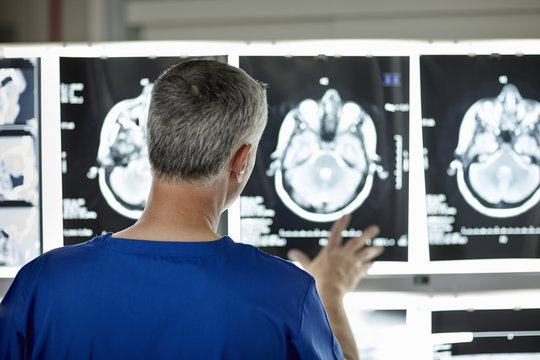 Rear view of radiologist examining the brain scans