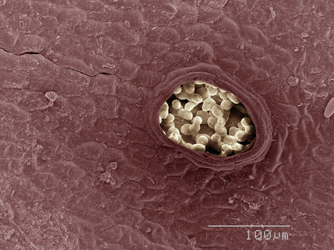 Coloured SEM of liverwort leaf