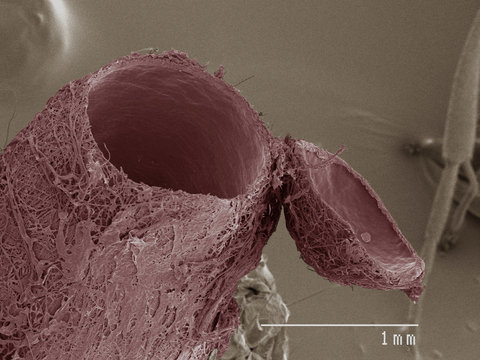 Coloured SEM of parasitic wasp