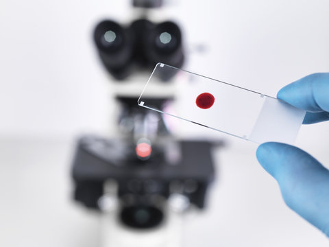Laboratory scientist holding a slide containing a blood sample with a upright compound microscope in the background