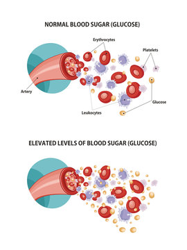 Artery and diabetes