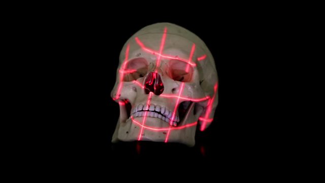 Three dimensional scan of human skull model with rotational grid