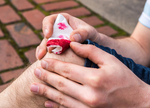 Mann ist am Knie verletzt