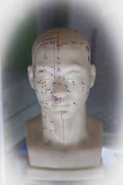 Acupuntura
