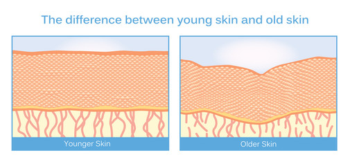 The difference between young skin and old skin. This illustration about skincare.