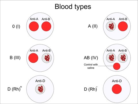 Determination of blood groups (types) with colyclons