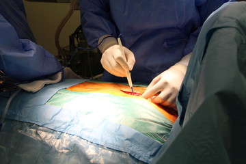 surgeon startign surgery