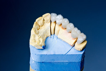 Reposición dental  - 107499173