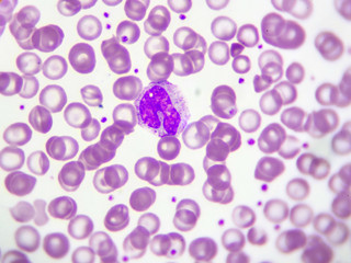 Monocyte cell (white blood cell) in peripheral blood smear, Wright stain
